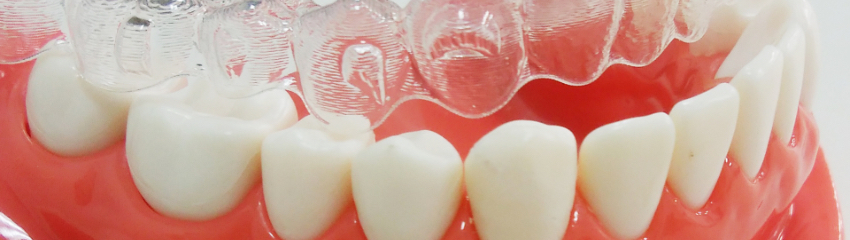 治療前に最新のホワイトニングマシーンによるホワイトニング（無料）でまず歯を白く美しくします。